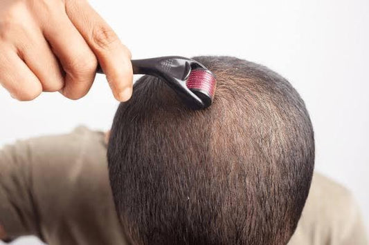 Derma Rolling and Minoxidil: How This Powerful Combination Can Boost Hair Growth