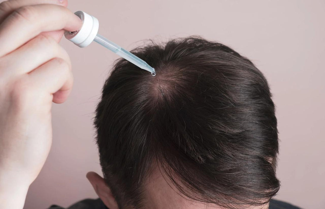 Minoxidil for Thinning Hair: Why It’s the Most Effective Treatment